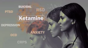 How Long Does Ketamine Work for Depression