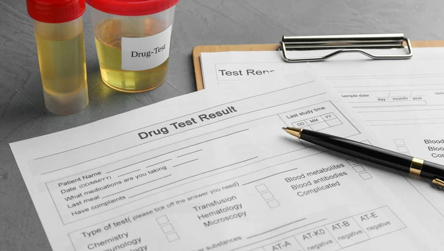 Drug Tests Detect Dilaudid