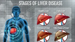 What are the Signs Your Liver Is Healing from Alcohol - South Shores Detox