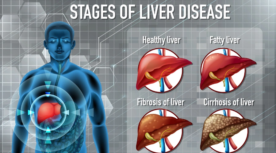 What are the Signs Your Liver Is Healing from Alcohol - South Shores Detox